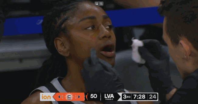 卡林顿上篮时肘击老将王牌海耶斯 后者立即满身是血 